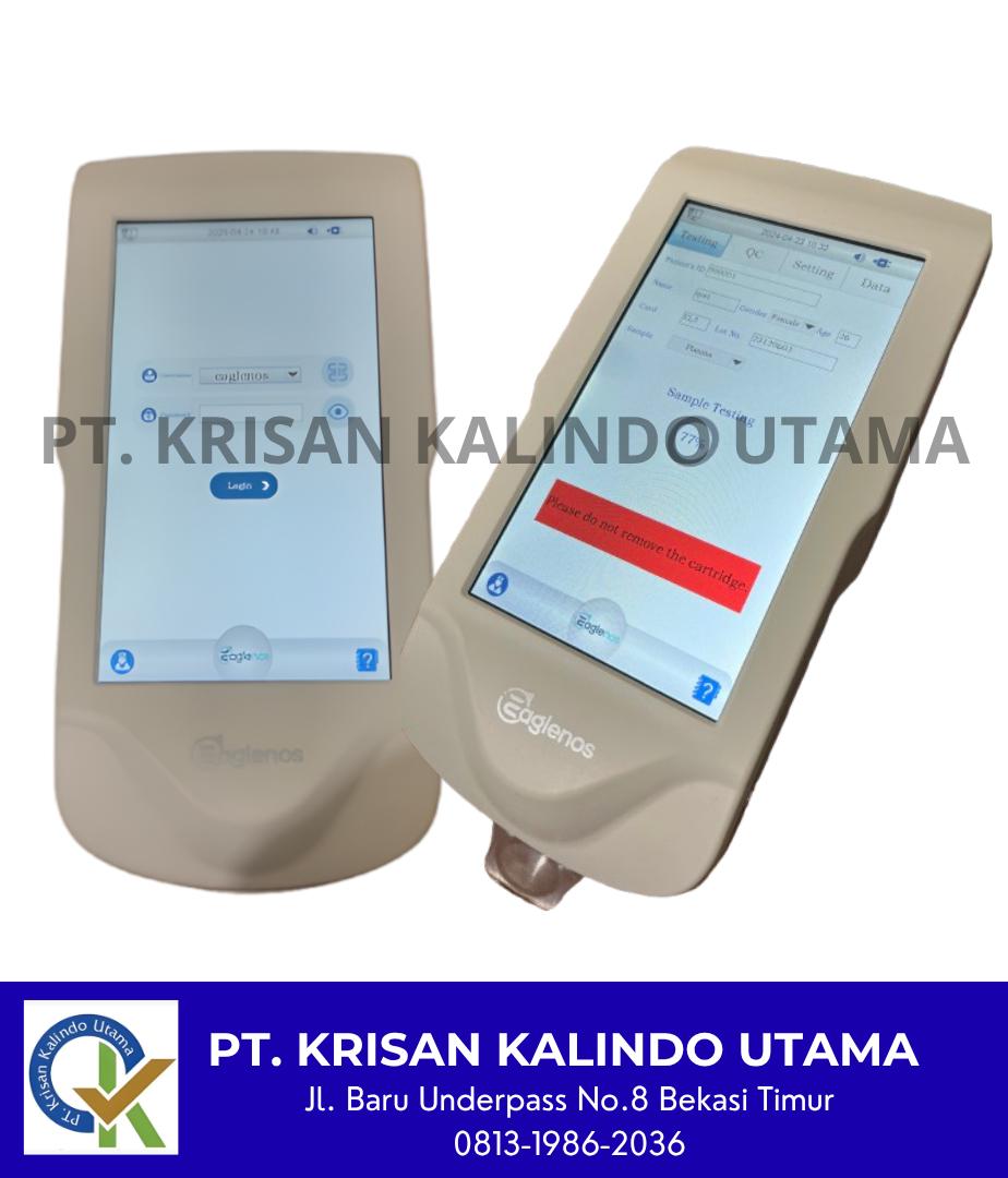 EAGLENOS  ELECTROLYTE  ANALAYZER